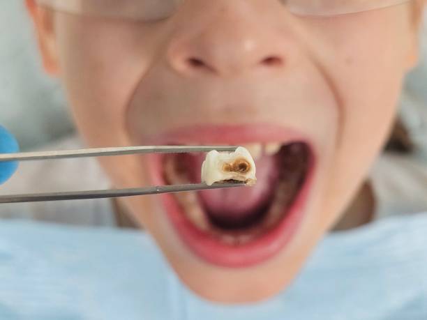 Best Same-Day Emergency Dental Services in Nett, MO